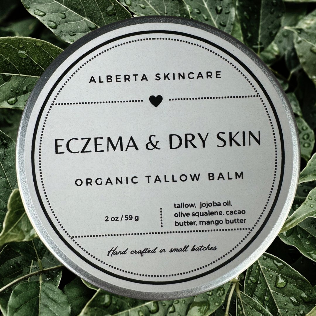 Eczema & Dry Skin Tallow Balm - Alberta Skincare