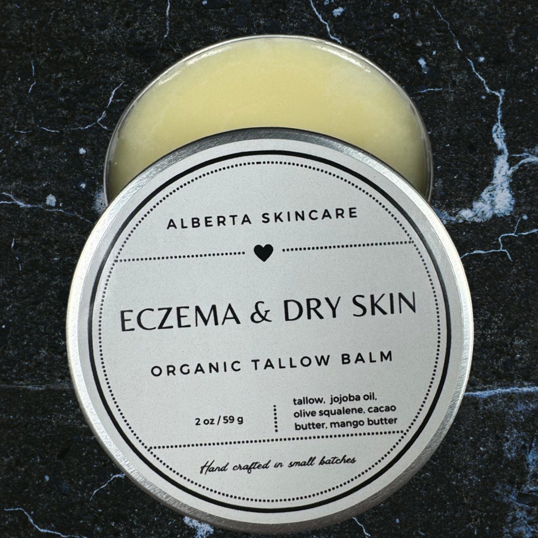 Eczema & Dry Skin Tallow Balm - Alberta Skincare